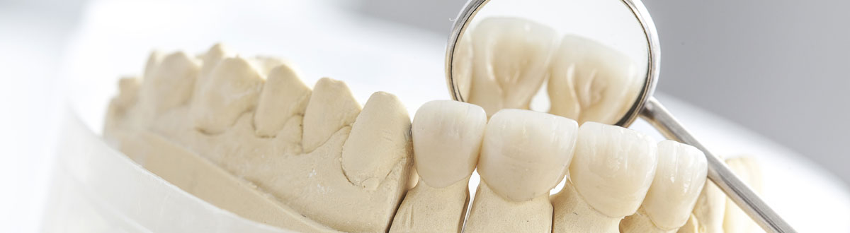 Keramikkronen aus dem Dentallabor Zahnwerk in Düsseldorf.